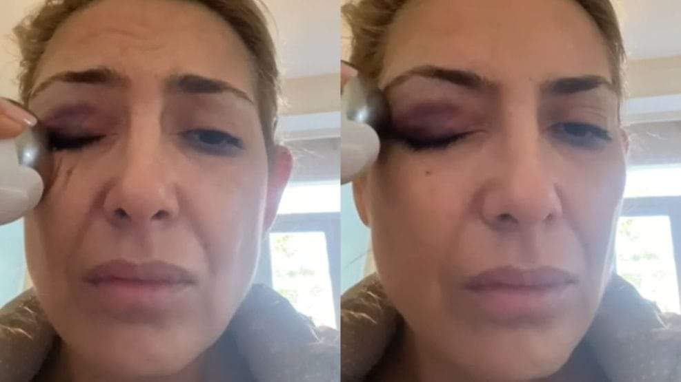 FABIOLA YAÑEZ PRESENTÓ NUEVAS PRUEBAS DE AGRESIONES EN LA CAUSA CONTRA ALBERTO FERNÁNDEZ.