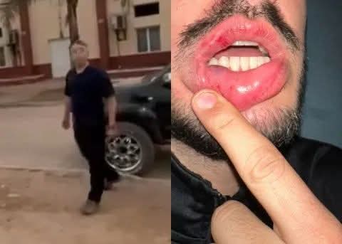 TACO POZO: DENUNCIARON A UN JEFE PROVINCIAL POR GOLPES Y DETENCIÓN ARBITRARIA.