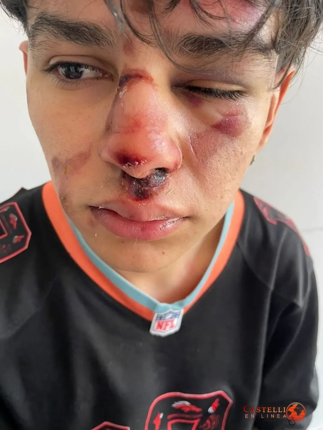 J.J CASTELLI: UN JOVEN RESULTÓ CON POLITRAUMATISMOS TRAS UNA VIOLENTA AGRESIÓN A LA SALIDA DE UN EVENTO BAILABLE 